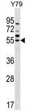 AP51647PU-N - Ferredoxin reductase