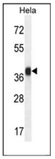 AP51696PU-N - Folate receptor alpha