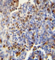 AP51699PU-N - Fos-related antigen 2