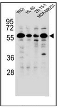 AP51704PU-N - FOXC2 / FKHL14 / MFH1