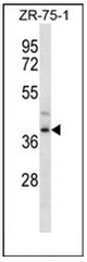 AP51721PU-N - FMLP-related receptor II