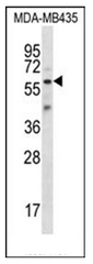 AP51728PU-N - Fascin-3