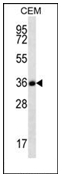AP51732PU-N - Follistatin-related protein 3