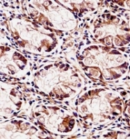 AP51745PU-N - Dysadherin / FXYD5