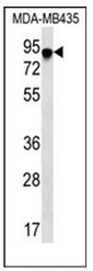 AP51746PU-N - FYN-binding protein