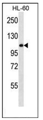 AP51752PU-N - Alpha-glucosidase / LYAG