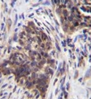 AP51752PU-N - Alpha-glucosidase / LYAG