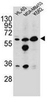 AP51788PU-N - Glycine amidinotransferase