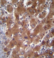 AP51789PU-N - Cytosolic beta-glucosidase