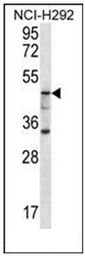 AP51789PU-N - Cytosolic beta-glucosidase