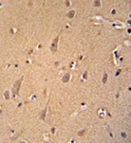 AP51797PU-N - GCC2