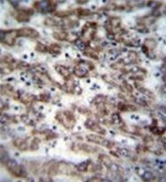 AP51799PU-N - GCD / GCDH