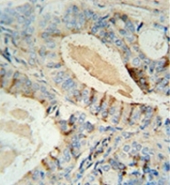 AP51803PU-N - GCNT2 / NACGT1