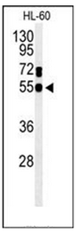 AP51807PU-N - Guanine deaminase