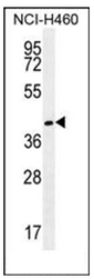 AP51829PU-N - Gamma-glutamyl hydrolase / GGH