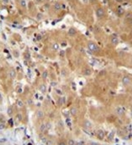 AP51830PU-N - Gamma-glutamyl hydrolase / GGH
