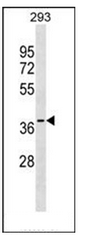 AP51831PU-N - GGPP synthetase