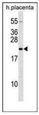 AP51834PU-N - Growth hormone 2