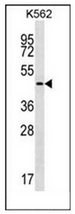 AP51837PU-N - Intrinsic factor