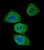 AP51837PU-N - Intrinsic factor