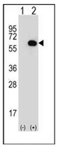 AP51844PU-N - Glycerol kinase