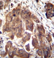 AP51853PU-N - Glomulin