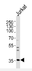 AP51858PU-N - Glycine receptor beta