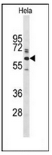 AP51865PU-N - Glypican-1 / GPC1