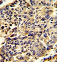 AP51865PU-N - Glypican-1 / GPC1