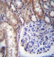 AP51871PU-N - G protein alpha 14
