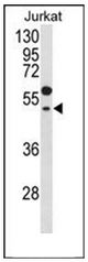 AP51875PU-N - Transducin alpha-1 chain / GNAT1