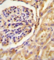 AP51876PU-N - GNAT2 / GNATC