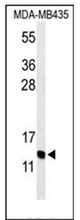 AP51886PU-N - GNRH2 / Progonadoliberin-2
