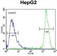 AP51899PU-N - GPAM / GPAT1