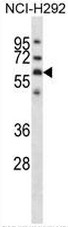 AP51902PU-N - Glypican-3 / GPC3
