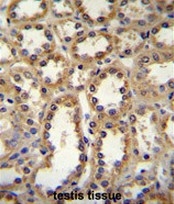 AP51904PU-N - Glypican-6 / GPC6