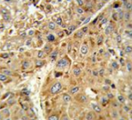 AP51937PU-N - Glutathione peroxidase 1 / GPX1