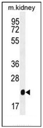 AP51939PU-N - Glutathione peroxidase 3 / GPX3
