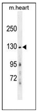 AP51952PU-N - NMDA Receptor 2A