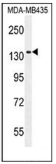 AP51953PU-N - NMDA Receptor 2A
