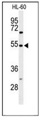 AP51959PU-N - Gastrin-releasing peptide receptor