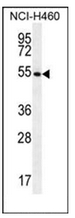 AP51963PU-N - Glutathione reductase