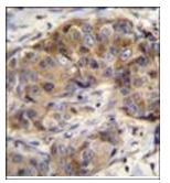 AP51963PU-N - Glutathione reductase