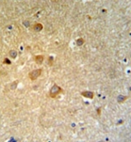 AP51981PU-N - GTSE1