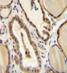 AP51984PU-N - GUCY2D / RETGC1