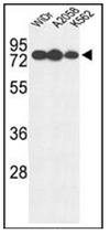 AP51986PU-N - Beta-glucuronidase