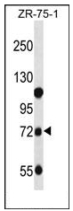 AP51987PU-N - Beta-glucuronidase