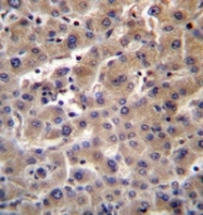 AP51987PU-N - Beta-glucuronidase