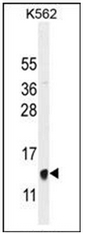 AP52007PU-N - Hemoglobin beta chain