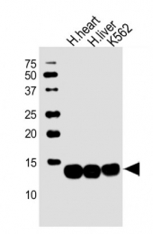 AP52007PU-N - Hemoglobin beta chain